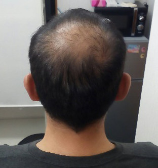 30代男性:before