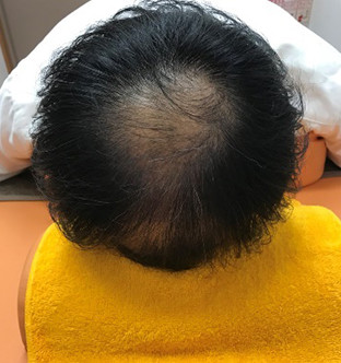 30代男性:before